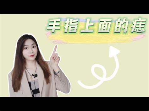 左手掌痣|左手痣位置大不同,命運各異